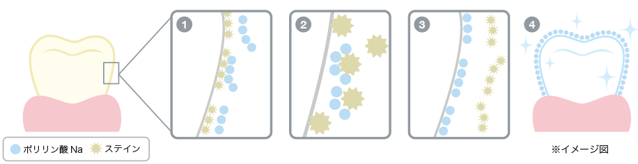ポリリン酸Naを使った最新ホワイトニング